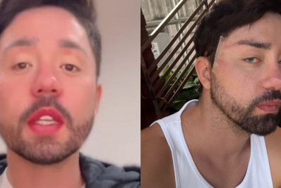 Rico fala sobre as críticas após revelar que realizou uma cirurgia para mudar a cor dos&nbsp;olhos