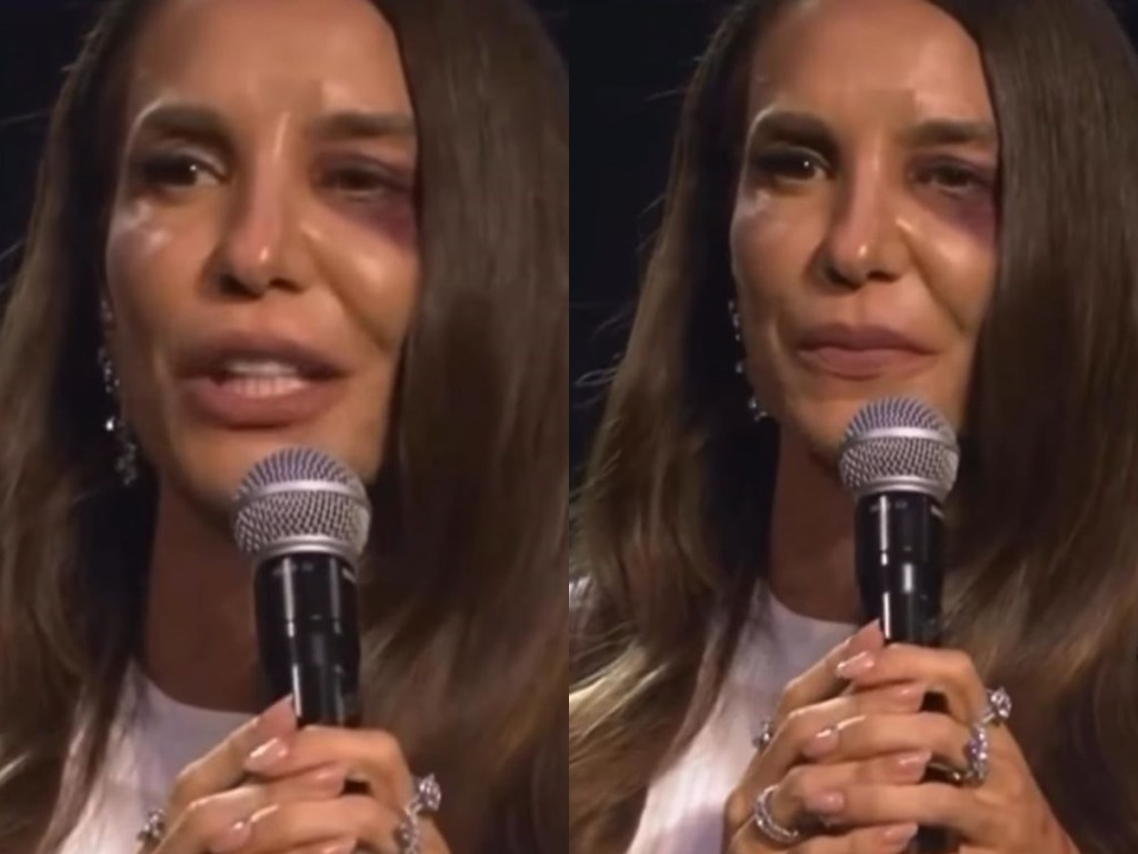 Ivete Sangalo confirma que passará por cirurgia após acidente em&nbsp;casa