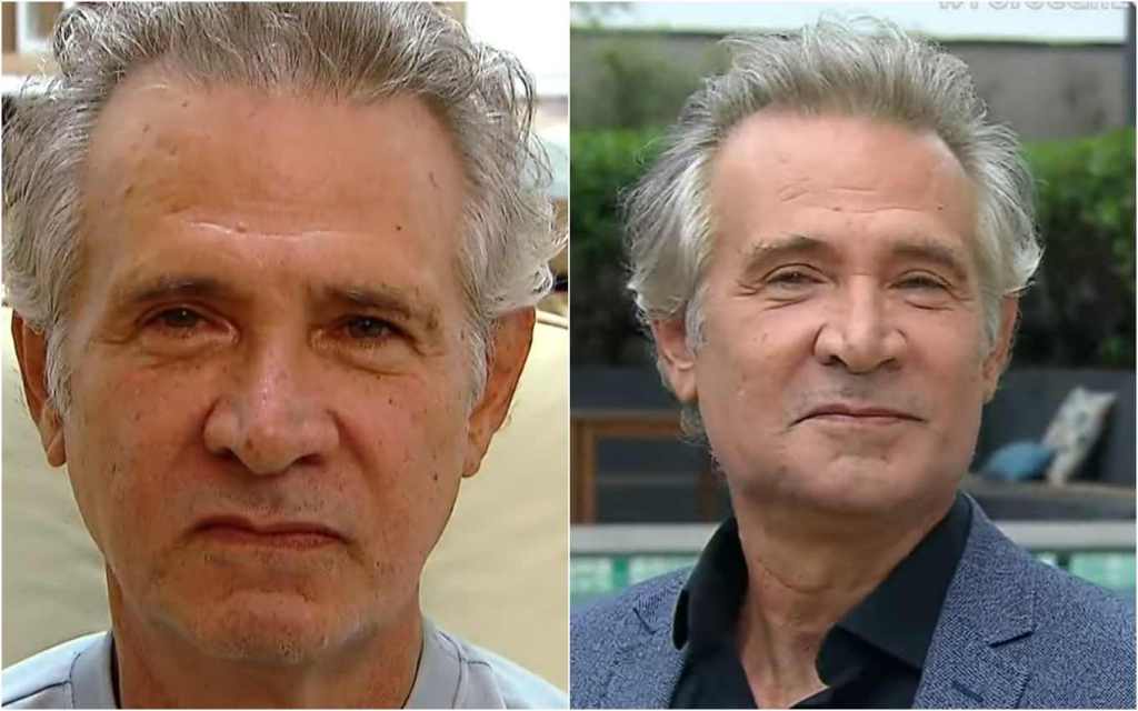 Nelson Freitas passa por procedimento estético aos 63&nbsp;anos