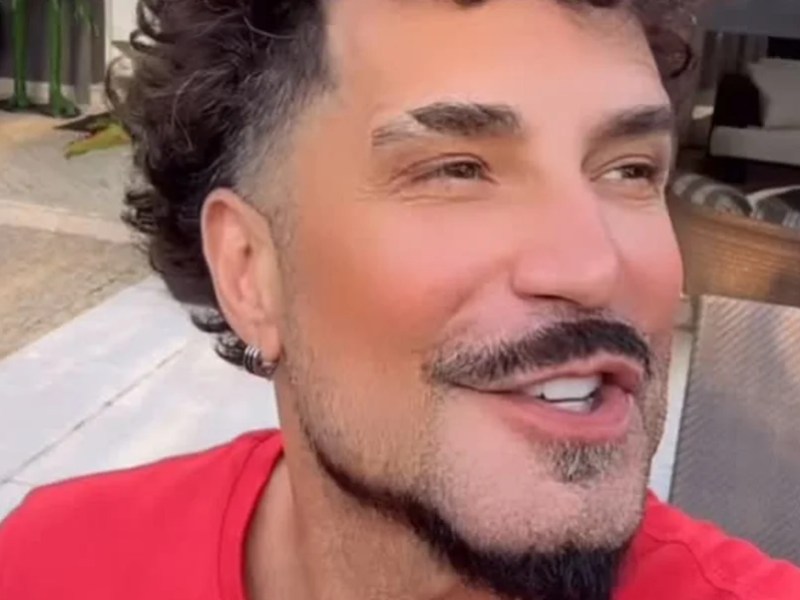 Latino reage após críticas sobre harmonização&nbsp;facial